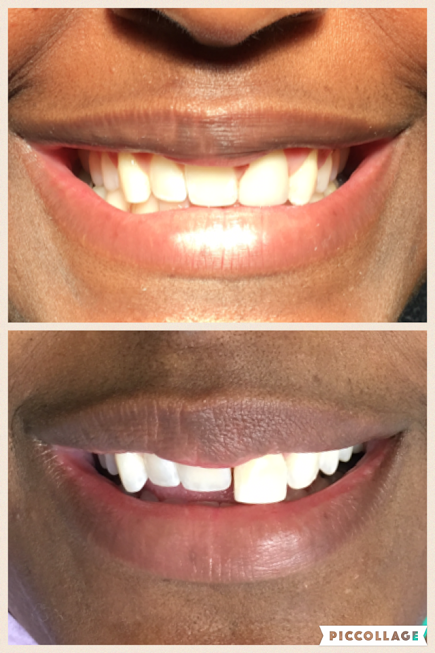 Linden Dental Before/After