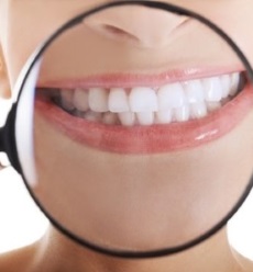 zoom-whitening-cosmetic-services
